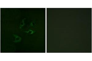 Immunofluorescence (IF) image for anti-Cas-Br-M (Murine) Ecotropic Retroviral Transforming Sequence (CBL) (AA 740-789) antibody (ABIN2888650) (CBL 抗体  (AA 740-789))