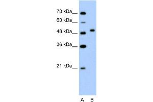 WB Suggested Anti-FLJ14213 Antibody Titration:  2. (FLJ14213 (N-Term) 抗体)