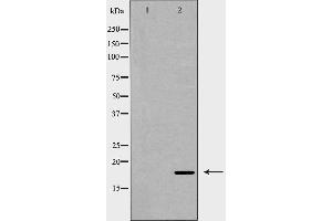 Western blot analysis of SOD1 expression in Jurkat cells,The lane on the left is treated with the antigen-specific peptide. (SOD1 抗体  (Internal Region))