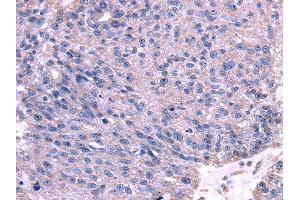 Immunohistochemistry (IHC) image for anti-Tripartite Motif Containing 14 (TRIM14) antibody (ABIN5961975) (TRIM14 抗体)