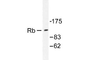 Image no. 1 for anti-Retinoblastoma 1 (RB1) antibody (ABIN271803) (Retinoblastoma 1 抗体)