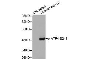 Western Blotting (WB) image for anti-Activating Transcription Factor 4 (Tax-Responsive Enhancer Element B67) (ATF4) (pSer245) antibody (ABIN1869995) (ATF4 抗体  (pSer245))