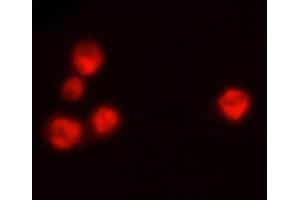 Wdpks1Δ-1 yeast cells treated with liquid nitrogen were stained with anti-melanin followed by Goat Anti-Mouse IgM, Human ads-TRITC (山羊 anti-小鼠 IgM (Heavy Chain) Antibody (TRITC))