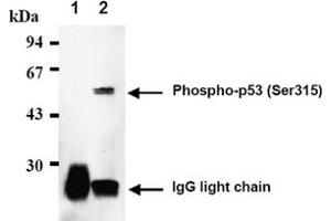 Western Blotting (WB) image for anti-Tumor Protein P53 (TP53) (pSer315) antibody (ABIN487474) (p53 抗体  (pSer315))