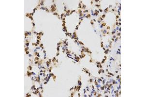 Immunohistochemistry (IHC) image for anti-Histone 3 (H3) (H3K9me) antibody (ABIN1872999) (Histone 3 抗体  (H3K9me))