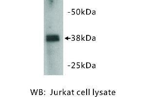 Image no. 1 for anti-Zinc Finger Protein 42 (ZFP42) antibody (ABIN1112835) (ZFP42 抗体)