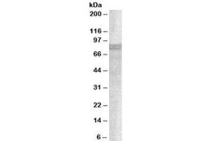 Western blot testing of A549 lysate with SNX18 antibody at 1ug/ml. (SNX18 抗体)