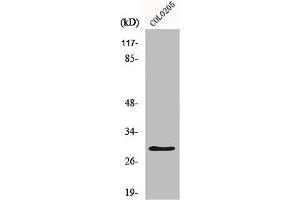 Western Blot analysis of COLO205 cells using HLA-DOα Polyclonal Antibody (HLA-DOA 抗体  (Internal Region))