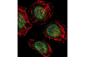 Fluorescent confocal image of Hela cell stained with CAF-1 Antibody (N-term). (CNOT8 抗体  (N-Term))