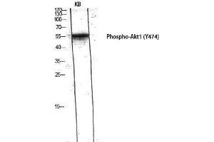 Western Blotting (WB) image for anti-V-Akt Murine Thymoma Viral Oncogene Homolog 1 (AKT1) (pTyr474) antibody (ABIN6283968) (AKT1 抗体  (pTyr474))