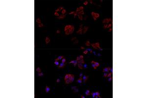 Immunofluorescence analysis of HeLa cells using CD40L antibody (ABIN6133614, ABIN6138190, ABIN6138191 and ABIN6216826) at dilution of 1:100. (CD40 Ligand 抗体  (AA 79-129))