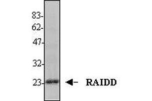 Image no. 1 for anti-CASP2 and RIPK1 Domain Containing Adaptor with Death Domain (CRADD) (AA 1-199) antibody (ABIN187937) (CRADD 抗体  (AA 1-199))