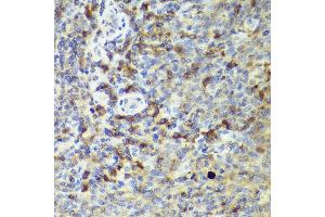 Immunohistochemistry of paraffin-embedded human tonsil using IL18 antibody (ABIN7267992) at dilution of 1:50 (40x lens). (IL-18 抗体)