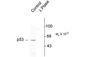 Image no. 2 for anti-Tumor Protein P53 (TP53) (pSer392) antibody (ABIN228202) (p53 抗体  (pSer392))