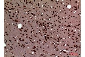 Immunohistochemical analysis of paraffin-embedded rat-brain, antibody was diluted at 1:100. (Pleiotrophin 抗体  (Internal Region))