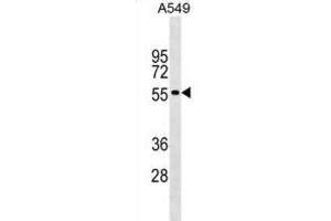 Western Blotting (WB) image for anti-Gliomedin (GLDN) antibody (ABIN2999543) (GLDN 抗体)