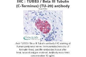 Image no. 1 for anti-Tubulin, beta 3 (TUBB3) (N-Term) antibody (ABIN1724161) (TUBB3 抗体  (N-Term))