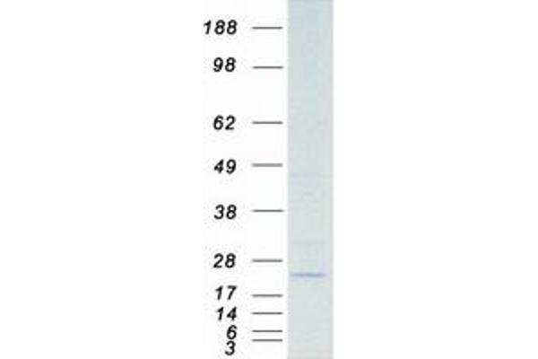 STK32A Protein (Transcript Variant 2) (Myc-DYKDDDDK Tag)