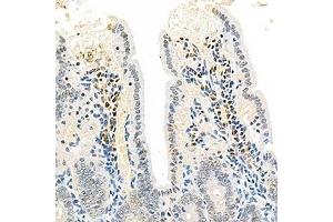 Immunohistochemistry analysis of paraffin-embedded mouse colon using,EEA1 (ABIN7073795) at dilution of 1: 2500 (EEA1 抗体)