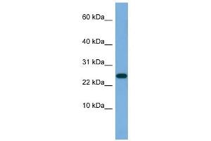 ANKRD39 antibody used at 0. (ANKRD39 抗体  (N-Term))