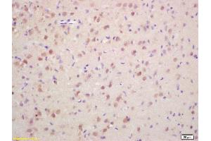 Formalin-fixed and paraffin embedded rat brain labeled with Rabbit Anti Phospho-Histone H3 (Ser10) Polyclonal Antibody, Unconjugated (ABIN742553) at 1:200 followed by conjugation to the secondary antibody and DAB staining (Histone 3 抗体  (pSer11))