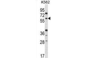 Western Blotting (WB) image for anti-Recombination Activating Gene 2 (RAG2) antibody (ABIN2996750) (RAG2 抗体)