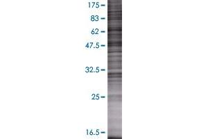 SFTPB transfected lysate. (SFTPB 293T Cell Transient Overexpression Lysate(Denatured))