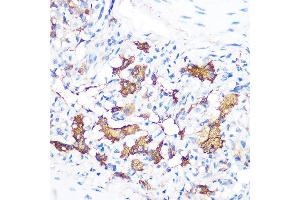 Immunohistochemistry of paraffin-embedded rat lung using FGF21 Rabbit mAb (ABIN1680154, ABIN3018263, ABIN3018264 and ABIN7101589) at dilution of 1:100 (40x lens). (FGF21 抗体)