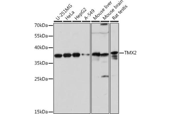 TMX2 抗体  (AA 128-296)