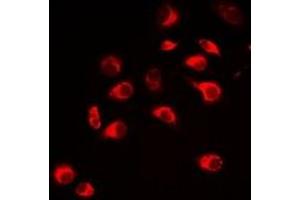 Immunofluorescent analysis of Carbonic Anhydrase 3 staining in Hela cells. (CA3 抗体)