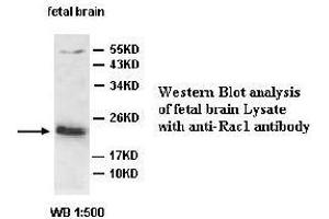 Image no. 2 for anti-RAC1 antibody (ABIN791257) (RAC1 抗体)