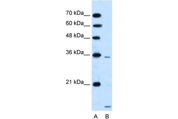 SLC25A39 抗体  (C-Term)