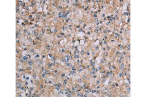 Immunohistochemistry (IHC) image for anti-Plexin A4 (PLXNA4) antibody (ABIN2435214) (Plexin A4 抗体)