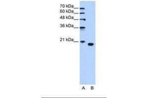Image no. 1 for anti-Phosphatidylethanolamine Binding Protein 1 (PEBP1) (C-Term) antibody (ABIN321403) (PEBP1 抗体  (C-Term))