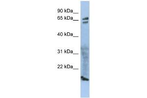 ZP1 antibody used at 1 ug/ml to detect target protein. (ZP1 抗体)