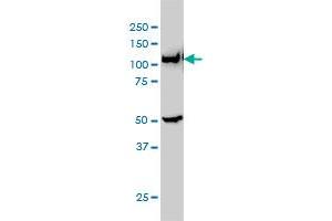 Western Blotting (WB) image for anti-Phosphoribosylglycinamide Formyltransferase (GART) (AA 1-433) antibody (ABIN560998)