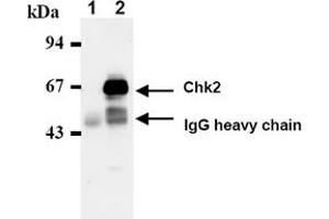 Western Blotting (WB) image for anti-Checkpoint Kinase 2 (CHEK2) antibody (ABIN487488) (CHEK2 抗体)