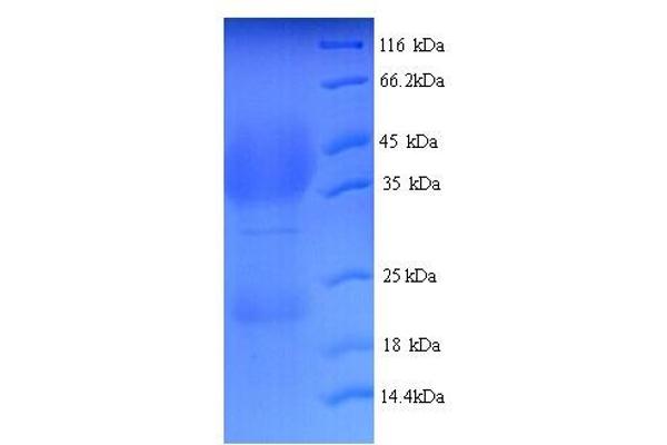 LHCGR Protein (AA 27-363) (His tag)