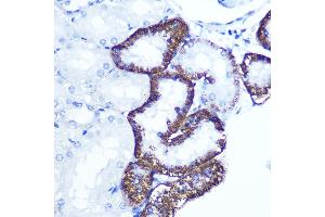 Immunohistochemistry of paraffin-embedded rat kidney using EXTL3 Rabbit pAb (ABIN1679782, ABIN3018195, ABIN3018196 and ABIN6220395) at dilution of 1:100 (40x lens). (EXTL3 抗体  (AA 52-220))