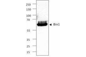 Western Blotting (WB) image for anti-Bridging Integrator 1 (BIN1) antibody (ABIN2664071) (BIN1 抗体)