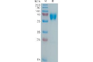 Human Protein, His Tag on SDS-PAGE under reducing condition. (MMP8 Protein (AA 21-467) (His tag))