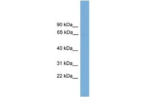 WB Suggested Anti-POLR3C Antibody Titration: 0. (POLR3C 抗体  (Middle Region))