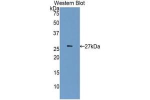 Detection of Recombinant CDK5, Human using Polyclonal Antibody to Cyclin Dependent Kinase 5 (CDK5) (CDK5 抗体  (AA 92-273))
