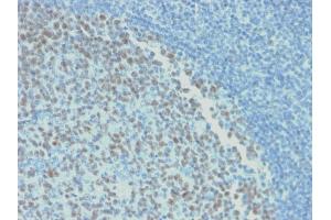 Formalin-fixed, paraffin-embedded human Tonsil stained with BCL-6 Mouse Recombinant Monoclonal Antibody (rBCL6/1718). (Recombinant BCL6 抗体  (AA 256-389))