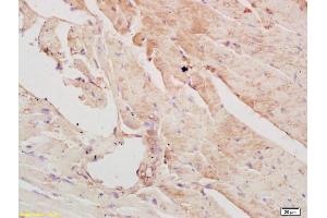 Formalin-fixed and paraffin embedded mouse heart labeled with Rabbit Anti PAPK/ALS2CR2 Polyclonal Antibody, Unconjugated (ABIN751273) at 1:200 followed by conjugation to the secondary antibody and DAB staining (STRADB 抗体  (AA 251-350))