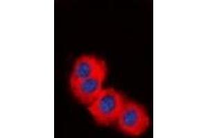 Immunofluorescent analysis of TSC2 staining in HepG2 cells. (Tuberin 抗体)
