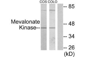 Western Blotting (WB) image for anti-Mevalonate Kinase (MVK) (Internal Region) antibody (ABIN1849535) (MVK 抗体  (Internal Region))