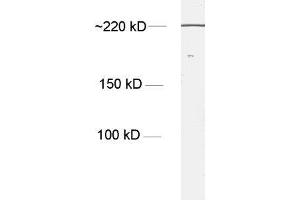 dilution: 1 : 1000, sample: NT2 cell lysate (Nestin 抗体)