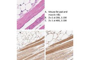 Immunohistochemistry (IHC) image for anti-Tight Junction Protein 1 (TJP1) antibody (ABIN6655949)