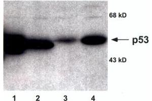 Image no. 1 for anti-Tumor Protein P53 (TP53) antibody (ABIN295785) (p53 抗体)